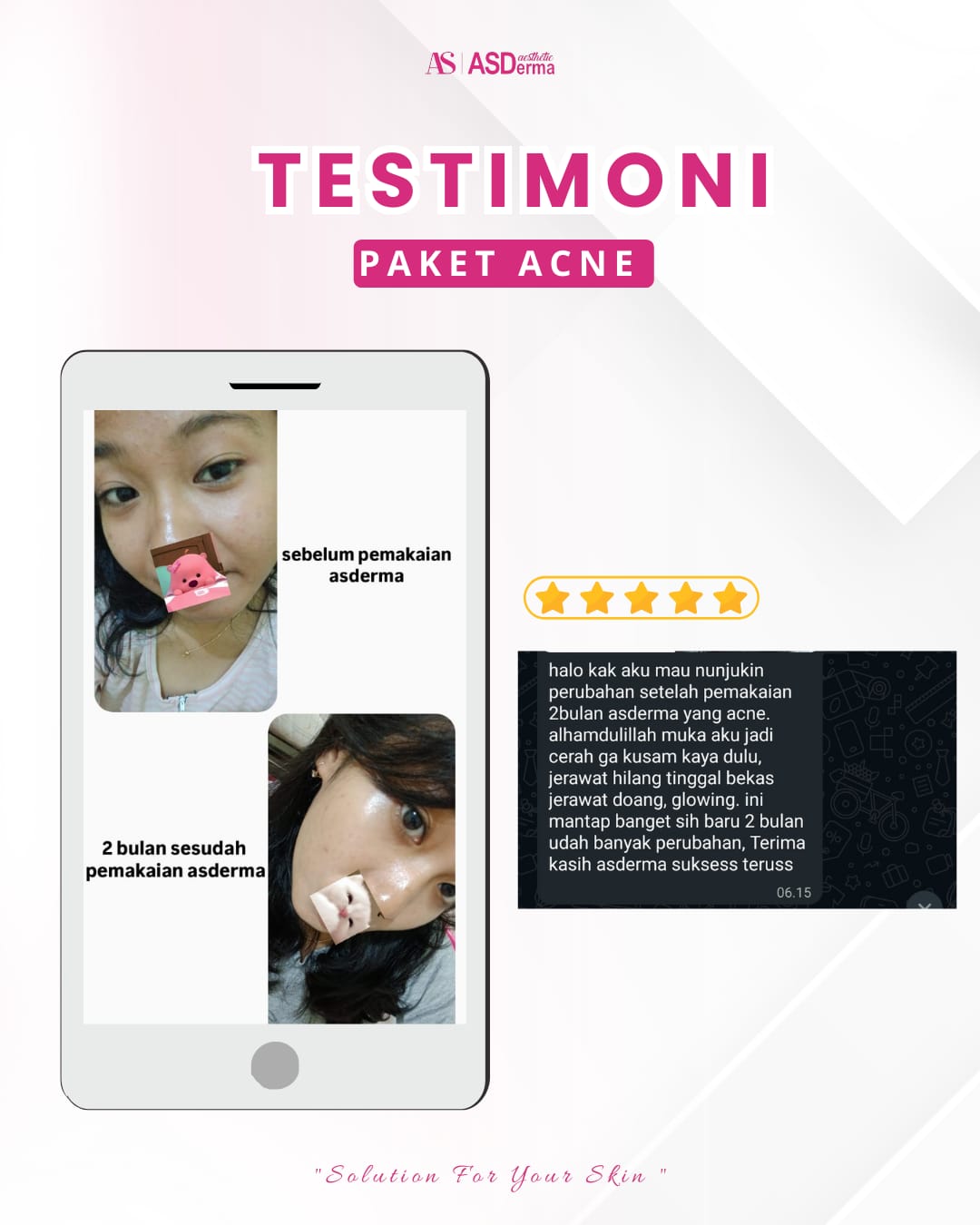 Testimoni 1